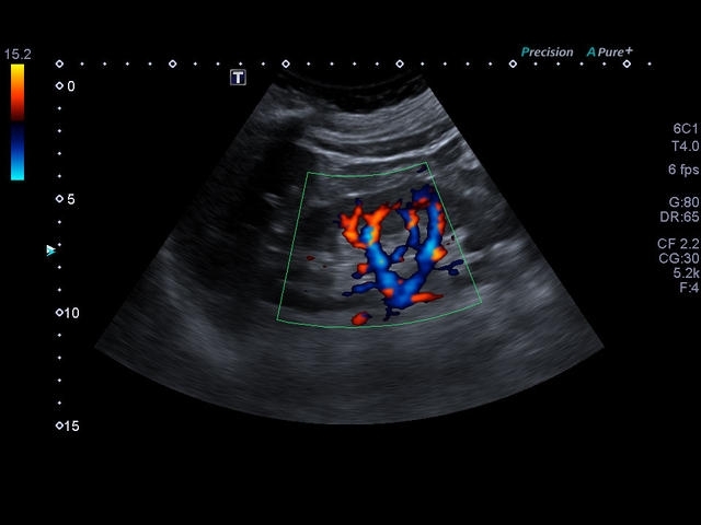 vy8v2cpyxtg7nm18cjuim7xivk43z2ow