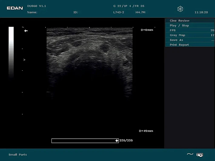 DUS60 L743-2  (1)_result