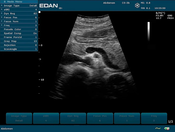 U2PE C5-2b Pancreas_result