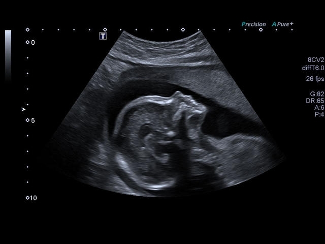 znsm8wyud6zlu9pwtzxrbajj4u5ow6r2