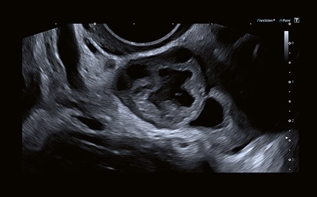 becr1t0jhfatnl5u7etok48twgp7qqdx