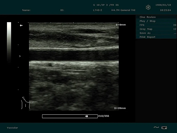 DUS60 L743-2 CCA_result