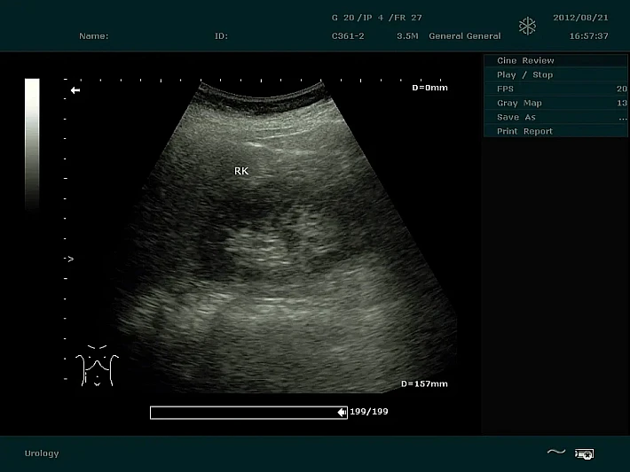 DUS60 C361-2 (2)_result