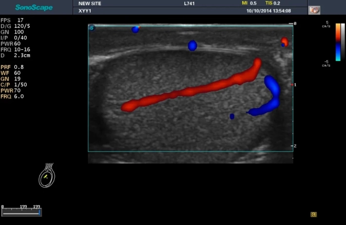 4. Testis_color_result