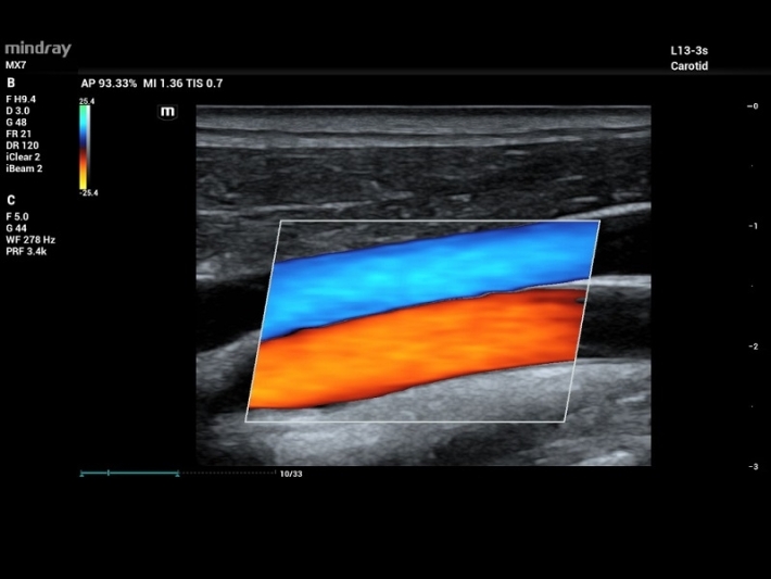 8Carotid-and-Jugular-Vein