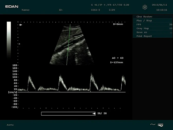 DUS60 C361-2 (3)_result