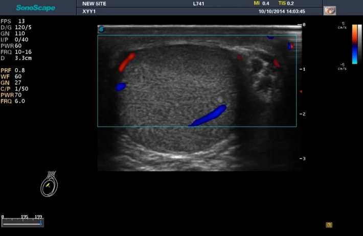 5. Testis_color_result