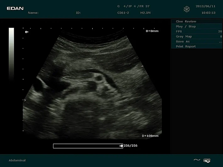 DUS60 C361-2 (5)_result