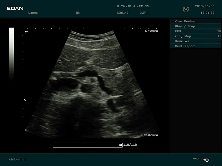 DUS60 C361-2 (6)_result