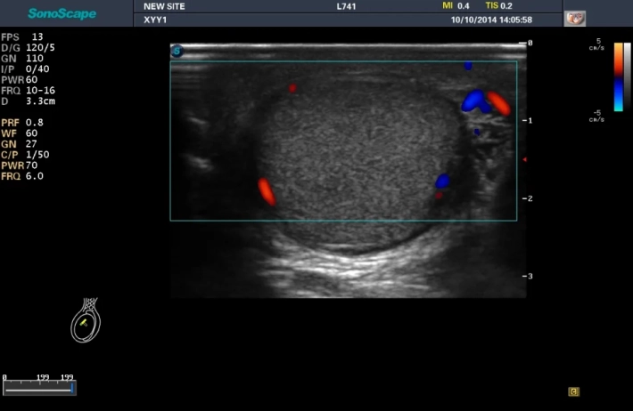 6. Testis_color_result