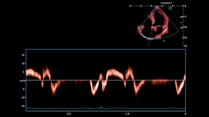 tvjfydq9cyxwuf4shcl3fpv7sekvknyf