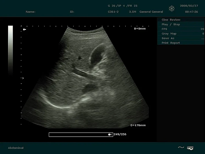 DUS60 C361-2 (7)_result