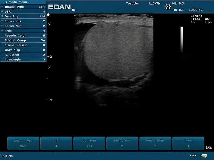 U50 PE L15-7b testis (1)_result