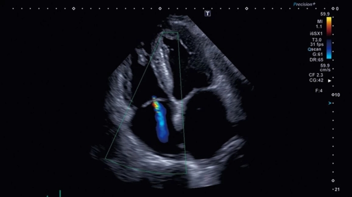 if3c19azr9elwugaubzi5zx656efmcip