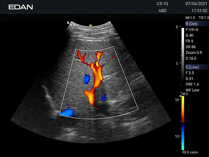 AX3 C5-1Q KIDNEY (4)_result