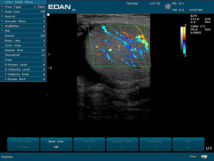 U50 PE L15-7b Colour testis (3)_result