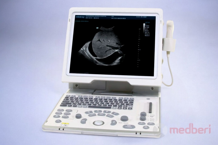 Портативный УЗИ-аппарат Mindray DP-50 б/у
