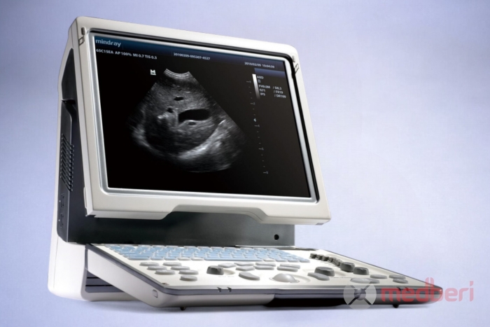 Портативный УЗИ-аппарат Mindray DP-50 б/у