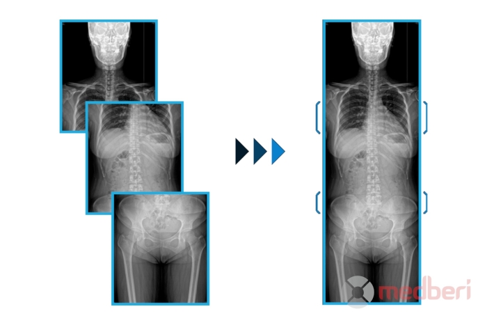Рентген-аппарат DRGEM REDIKOM-GXR LITE
