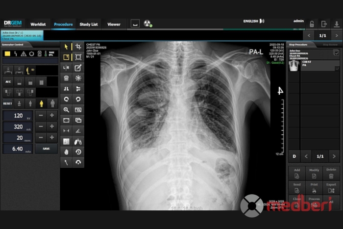 Рентген-аппарат DRGEM REDIKOM-GXR LITE