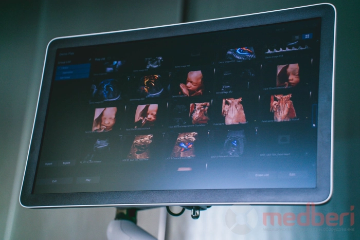 УЗИ аппарат Samsung Medison W9