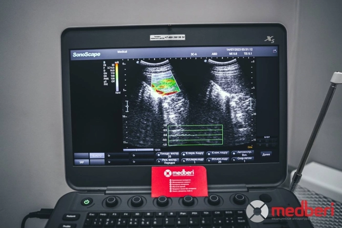 УЗИ аппарат SonoScape X5