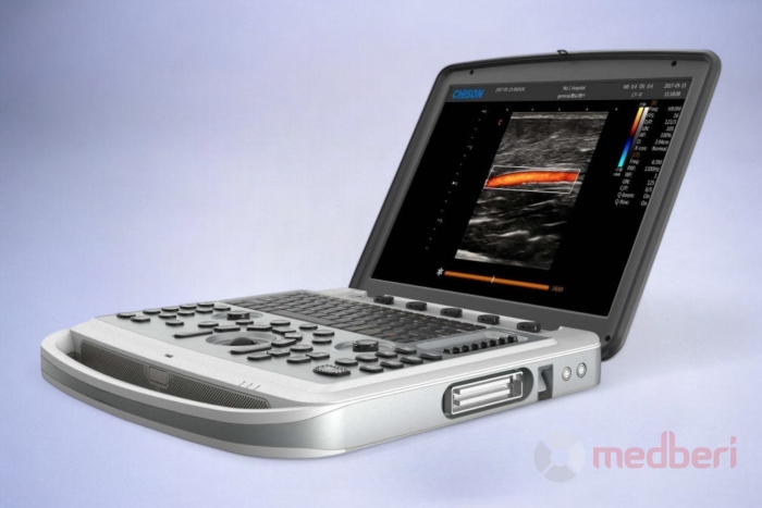 УЗИ-аппарат Chison SonoBook 6