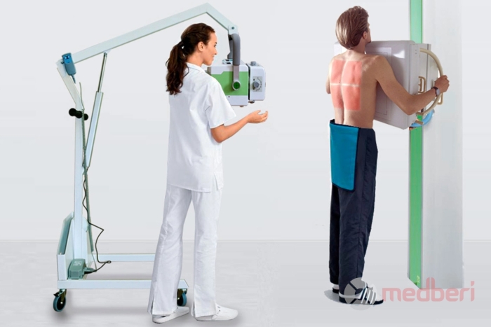 Портативный рентген-аппарат EcoTron EPX-3200