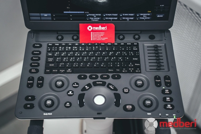 УЗИ аппарат SonoScape E1