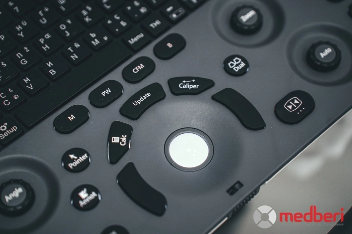 УЗИ аппарат SonoScape E1