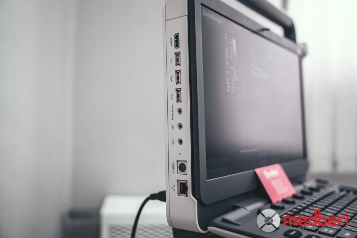 УЗИ аппарат SonoScape E3