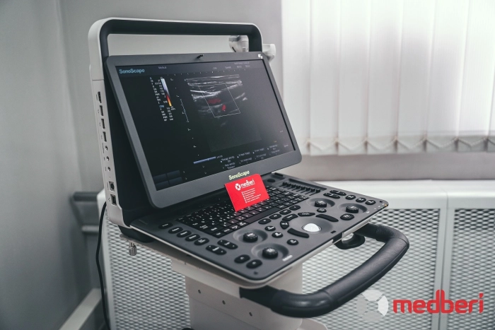 УЗИ аппарат SonoScape E3