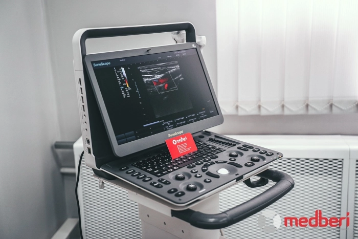 УЗИ аппарат SonoScape E3
