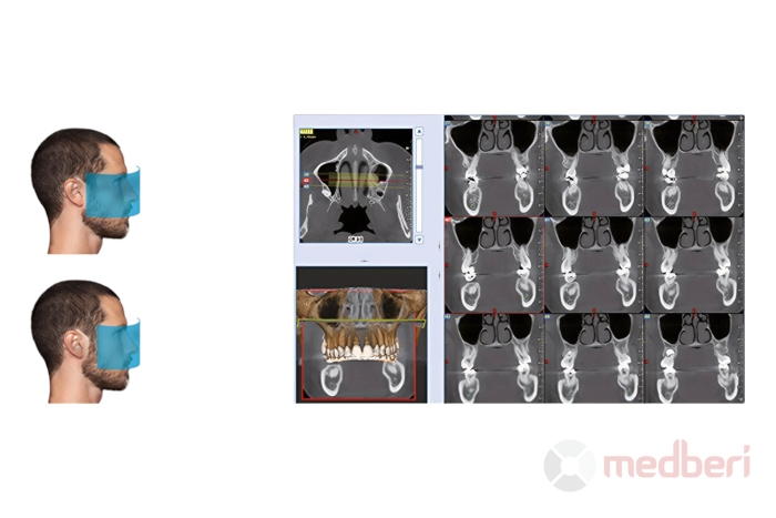 Стоматологический томограф NewTom 2D/3D Go