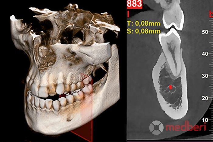 Стоматологический томограф NewTom 2D/3D Go