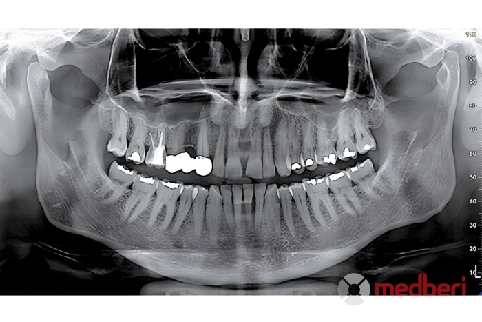 Стоматологический томограф NewTom 2D/3D Go
