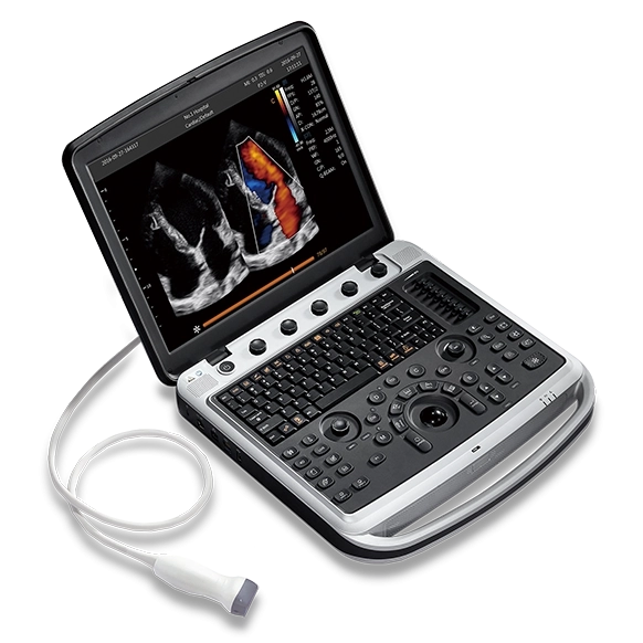 УЗИ-аппарат CHISON SonoTouch 80 Expert (Sonobook 9)