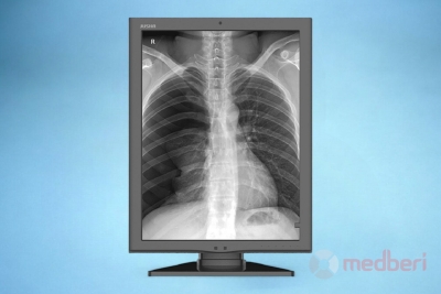 Медицинский монитор Jusha M350G