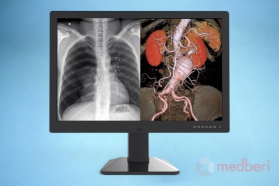 Медицинский монитор Jusha C61