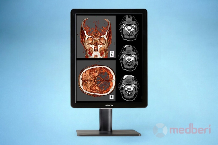 Медицинский диагностический монитор Barco Nio Color 2MP