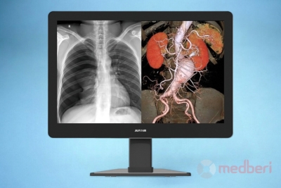 Медицинский монитор Jusha C620G