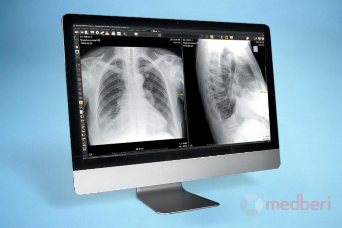 Рабочая станция врача ЛИНС Махаон