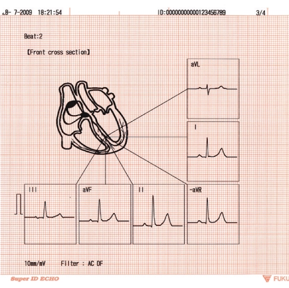 Электрокардиограф FX-8222