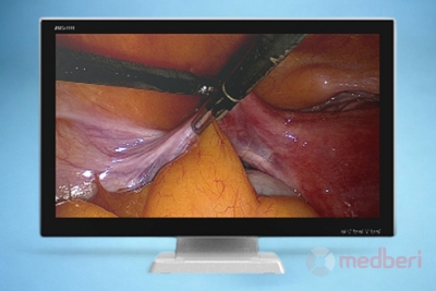 Медицинский монитор Jusha E260A