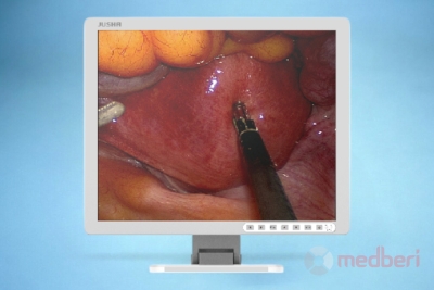 Медицинский монитор Jusha E190DG