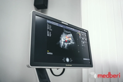 SonoScape S40Exp Vet