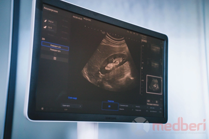 УЗИ аппарат Samsung Medison HS30